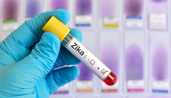 केरल के बाद अब महाराष्ट्र पहुंचा Zika Virus संक्रमण, पुणे की महिला संक्रमित