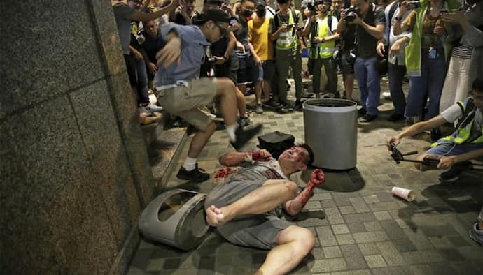 हांगकांग का खूनी खेल- हमलावर ने नेता का कान काटा , 5 लोगों पर किया चाकू से वार