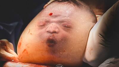 लेबर रूम के अंदर खींची गई ये तस्वीरें, कैमरे में कैद हुए जन्म के ये खूबसूरत पल