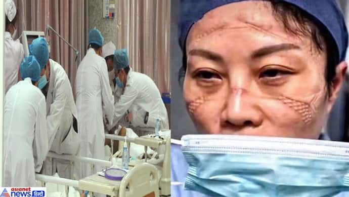 चीन में कोरोना वायरस से लगातार मर रहे डॉक्टर और नर्से भी,  6 की मौत, 1 हजार 716 चपेट में