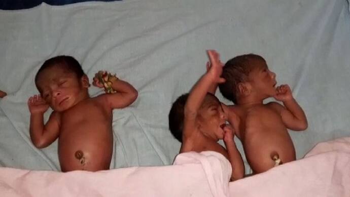 प्रसव के 4 घंटे बाद महिला ने फिर दिया 1 और नवजात को जन्म, 2 बार ऑपरेशन से निकलें 3 शिशु , पेट देख उड़े होश