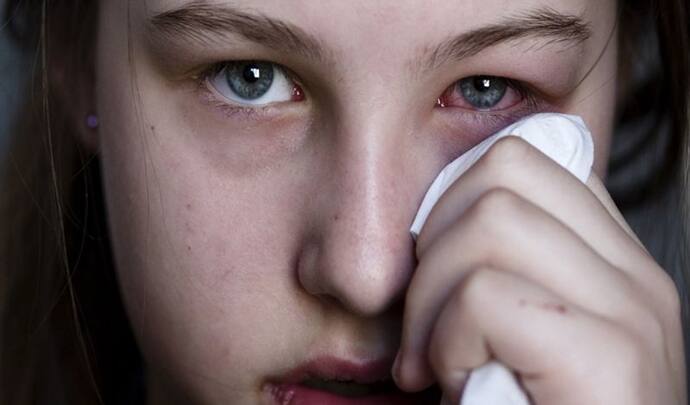 मुंह में निवाला डालते ही आंखों से बहने लगते हैं आंसू, दुनियाभर में सिर्फ 95 लोग इस सिंड्रोम से पीड़ित 