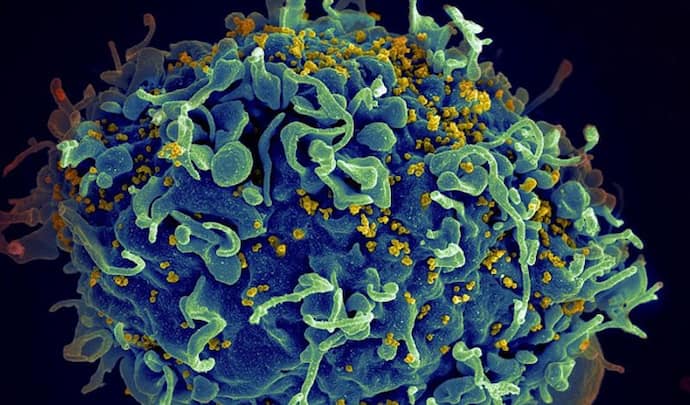 HIV+  মহিলার শরীরে ৩২ বার করোনার রূপ বদল, Covid 19-এ আক্রান্তের ২১৬ দিনের লড়াইয়ে চিন্তা গবেষকদের
