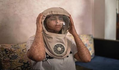 इस कारण 'एलियन' बन गई ये महिला, 24 घंटे पहनती है स्पेससूट, 20 साल से खुद को घर में छिपाकर है रखा