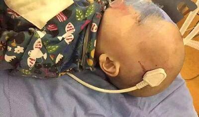 मासूम को इस हाल में अस्पताल ले पहुंची मां, सिर में धंसा पावर प्लग निकालते हुए डॉक्टरों के भी हाथ कांपे