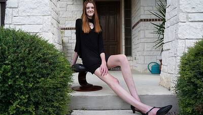 इस 17 साल की लड़की की हैं दुनिया में सबसे लंबी टांगे, नहीं मिलते नाप के कपड़े; बनना चाहती है मॉडल