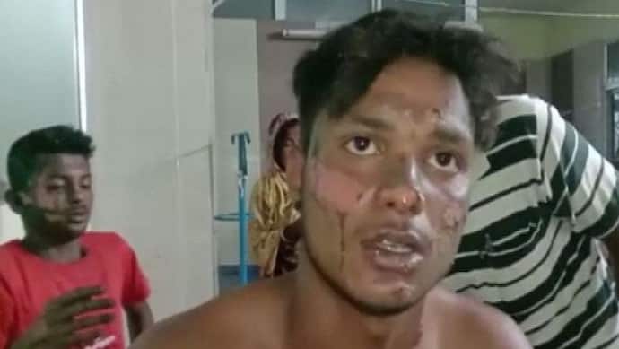 पश्चिम बंगाल : बम विस्फोट में बीजेपी कार्यकर्ता की मौत, 5 घायल, कैसे हुआ ये हादसा