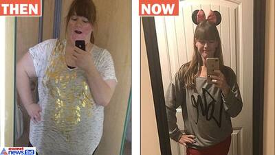 weight loss story: 190 किलो की लड़की ने घटाया 127 kg वजन, वेट लॉस जर्नी है बहुत दर्दनाक