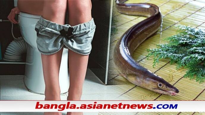 Viral News - পায়ুছিদ্র দিয়ে ঢোকালেন জ্যান্ত মাছ, চিনা টোটকায় কোষ্ঠকাঠিন্য সারল কি