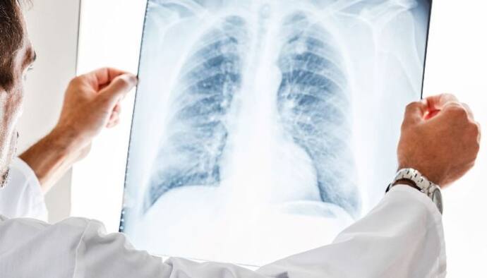 Lungs Health: ফুসফুস পরিষ্কার থাকলে মুক্তি মিলবে জীবাণু সংক্রমণ থেকে, রইল ফুসফুস পরিষ্কার রাখার উপায়