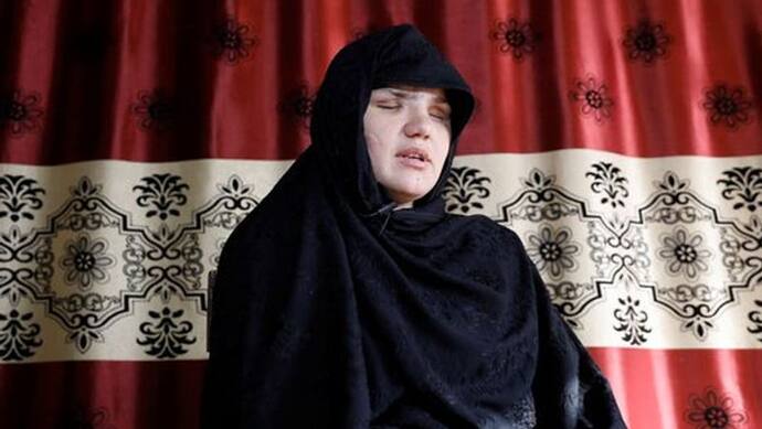 महिलाओं को कुत्तों से कटवाते हैं, तालिबान की शिकार महिला ने कहा- उन्होंने मेरी आंखें निकाल ली
