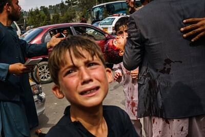 तालिबान के टेरर को बयां कर रही है यह तस्वीर: गोद में खून से सना बेटा-पास खड़ा बच्चा मांगता रहा रहम की भीख