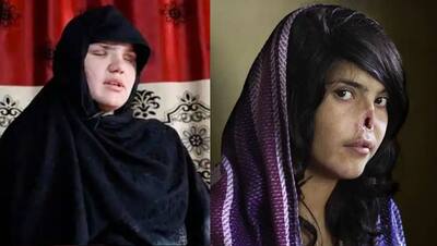 8 तस्वीरें बताती हैं इंसान नहीं राक्षस हैं तालिबानीः किसी की नाक काटी-किसी की आंख निकाल ली