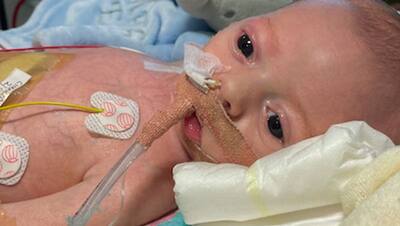 Shocking: 15 गर्भपात के बाद महिला ने दिया इस बच्चे को जन्म, अब ऐसी बीमारी हुई कि 8 हफ्तों में की गई 5 सर्जरी