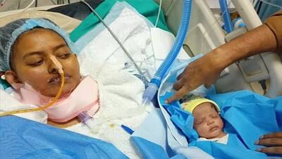 सैंकड़ों जान बचाने वाली लेडी डॉक्टर की थमी सांसे, 140 दिन वेंटिलेटर रहीं..मौत से पहले बच्ची को दिया जन्म