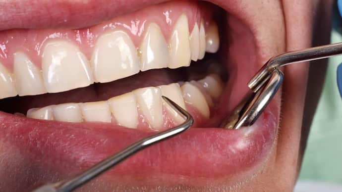 Signs of teeth, Research on teeth, Five things about teeth, Relationship of teeth with health, Meaning of yellow teeth, Problems in eating, Meaning of broken teeth
