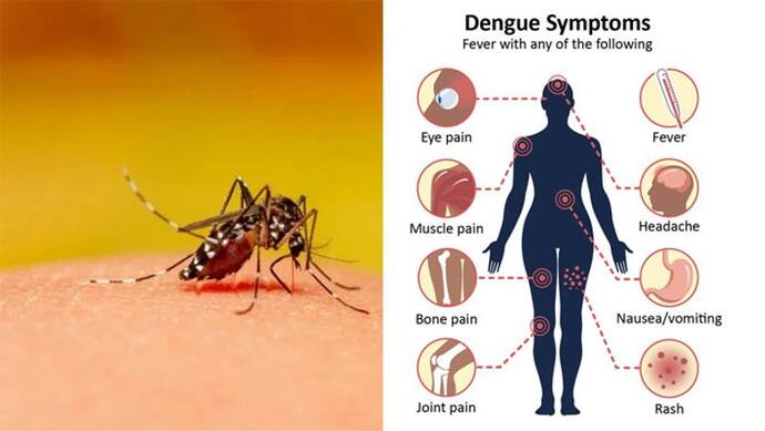 Dengue Alert: 9 राज्यों में खतरे की घंटी, केंद्र सरकार ने भेजी हाईलेवल टीम; जानिए इसके लक्षण
