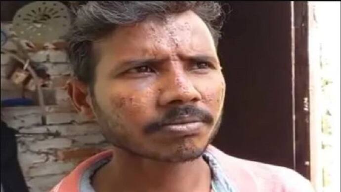सहारनपुर में इस बात से नाराज दबंगों ने युवक के माथे पर बना दिया त्रिशूल, पुलिस ने कहा- झूठे हैं आरोप