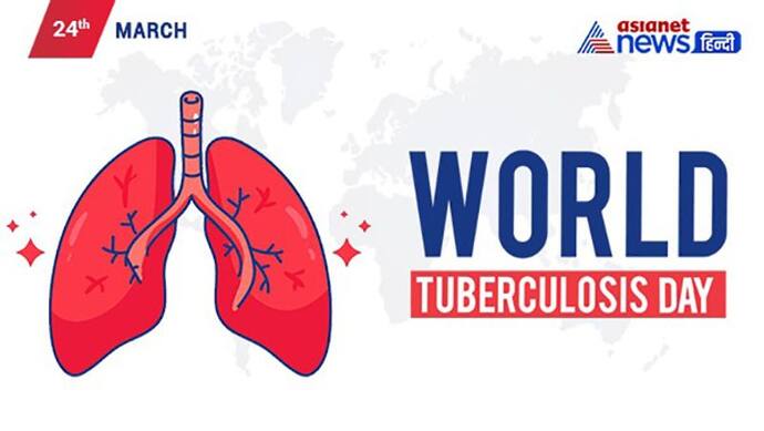 World TB Day 2022: क्या होता है DOTS? जानें सबसे घातक संक्रमण से बचने का  तरीका