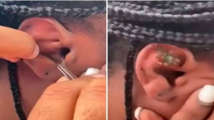 महिला के कान को घर समझकर अंदर घुस गया केकड़ा, वायरल वीडियो में देखिए आगे क्या हुआ 