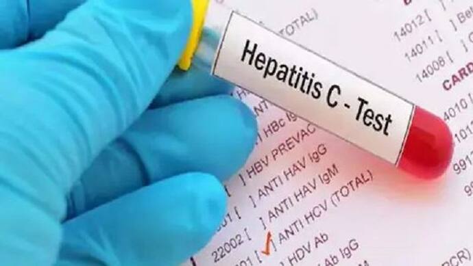 संभल के गांव में एक साथ 129 लोग हुए हेपेटाइटिस सी का शिकार, जांच में जुटी स्वास्थ्य विभाग की टीम