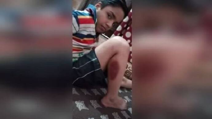 खूंखार कुत्तों के आतंक से भाजपा नेता का बेटा बुरी तरह से हुआ घायल, लोगों में अफसरों के प्रति गुस्सा