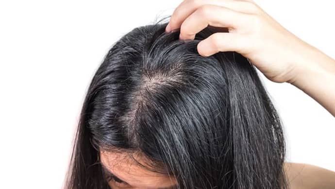 Oily Hair Remedy: ग्रीसी और चिपचिपे बालों से पाए छुटकारा, बस शैम्पू में मिलाकर यूज करें ये चीज