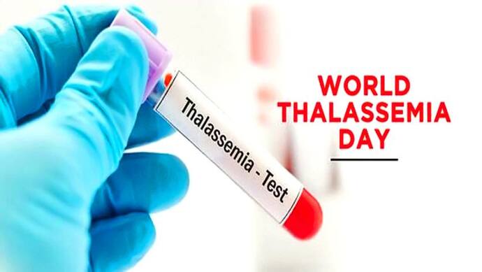 World Thalassemia Day 2022: कब और क्यों मनाया जाता है वर्ल्ड थैलेसीमिया डे, आखिर क्या है ये बीमारी