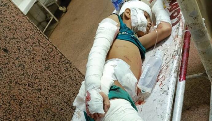 भोपाल में खतरनाक बुआ: 10 साल के भतीजे की बॉडी चाकुओं से कर दी छलनी, हाथ-पैर सीना और खोपड़ी पर मारे इतने चाकू