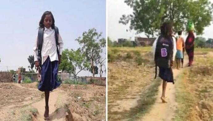 बिहार की इस बेटी के हौसले को सलाम: नहीं है एक पैर, लेकिन जज्बा ऐसा कि रोज 1 KM कूदकर जाती है स्कूल, खुद देखिए