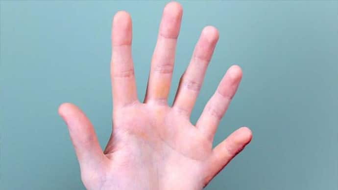 किस्मत के धनी होते हैं वे लोग जिनके हाथों में होती हैं 6 उंगली, ये हर काम करते हैं अलग तरीके से