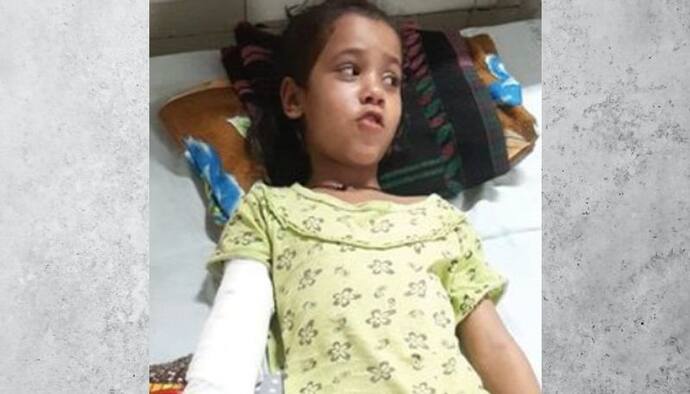 जयपुर के गांधीनगर में मां के साथ घूम रही 7 साल की बच्ची को घसीट ले गया डॉग, करानी पड़ी प्लास्टिक सर्जरी