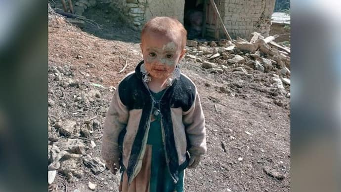 अफगानिस्तान Earthquake: भूकंप में मर गई पूरी फैमिली, पर इस बच्ची की प्यारी मुस्कान देखकर मानों मौत भी पिघल गई