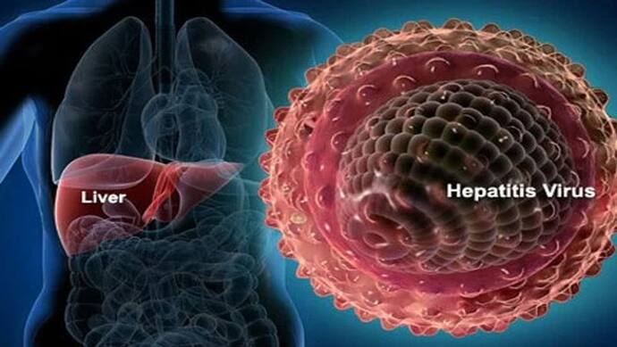 World hepatitis day: कितनी खतरनाक है यह बीमारी, क्या है इसके लक्षण, जानें कब हो सकती है जानलेवा