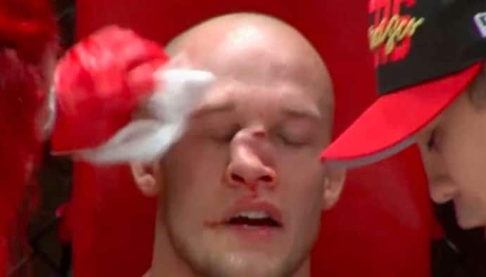 MMA फाइट के दौरान खिलाड़ी की नाक टूट गई.. फिर भी रिंग में आने को था बेताब, दिल कमजोर है तो ये वीडियो मत देखिए