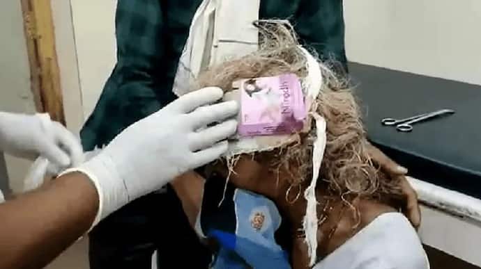 MP का शर्मनाक कांड: इलाज के लिए गई महिला के सिर पर लगाया कंडोम रैपर, होश उड़ा देगी घटना...देखिए वीडियो