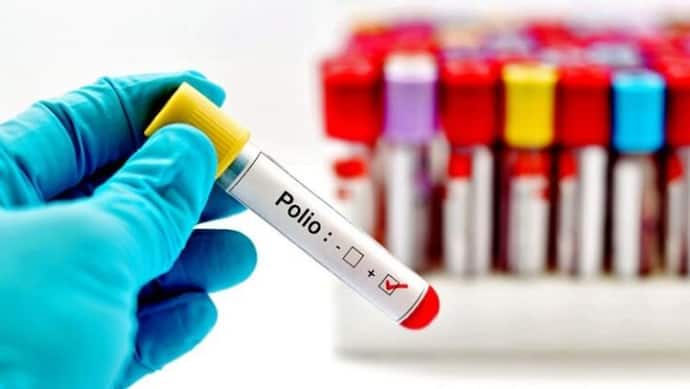 पोलियो वायरस ने दी फिर दस्तक, संक्रमण के मामले सामने आने के बाद अमेरिका में जारी हुआ अलर्ट