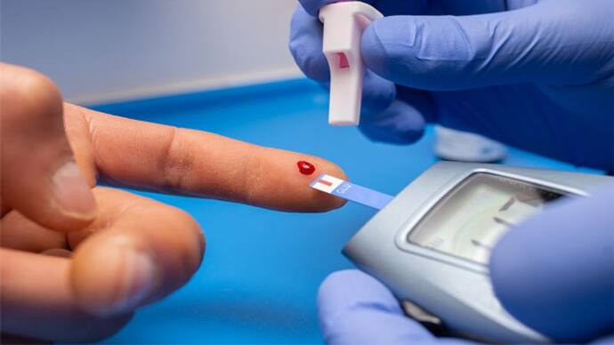 What is Type-1, type 2 and type-3 diabetes