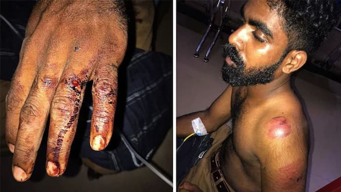 केरल पुलिस के वर्दीवाले गुंडे: फौजी और उसके भाई को लॉकअप में बुरी तरह पीटा, जख्म देखकर DGP के भी उड़े होश