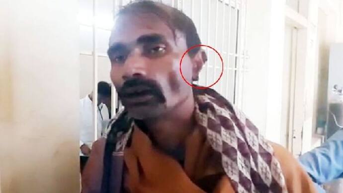 बिहार में शॉकिंग घटना: भतीजे ने चबा डाला चाचा कान, फिर साथ ले गया खून से सना टुकड़ा 