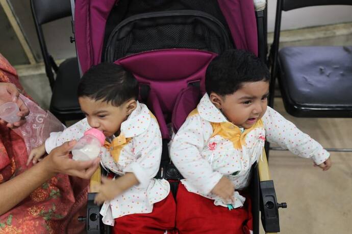 Conjoined twins: रीढ़ की हड्डी से जुड़े 'नुहा-नाबा' को देखकर PM शेख हसीना हुईं शॉक्ड, लिया एक बड़ा फैसला