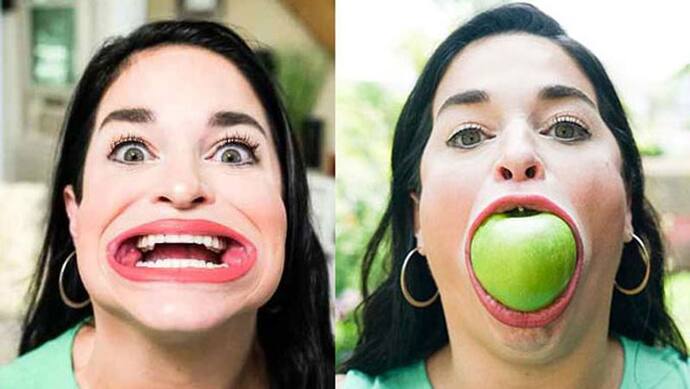 Largest Mouth Gap : ये है दुनिया में सबसे चौड़े मुंह वाली महिला, एक बार में निगल जाती है पूरा बर्गर