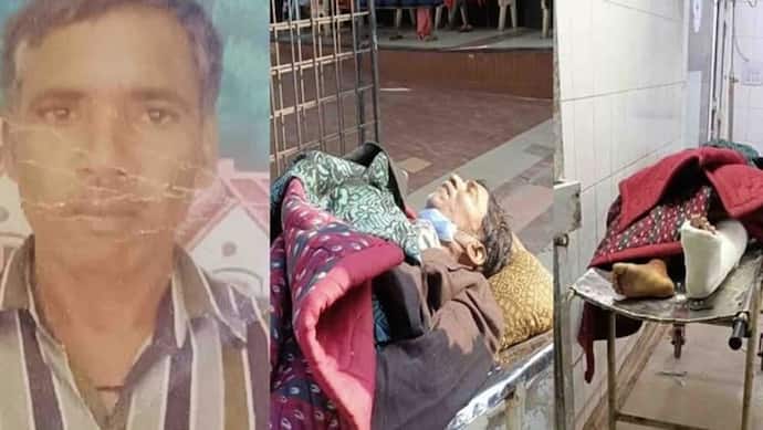 वाह रे भगवान! कानपुर में रातभर दर्द से तड़पता रहा मरीज, मौत होने के बाद पैर में बांधा प्लास्टर