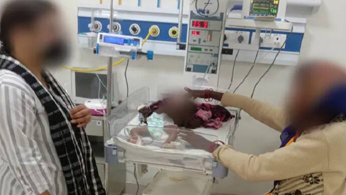 shahdol news three month old girl suffering from pneumonia died of superstition when she was poked by hot rod on stomach 51 times