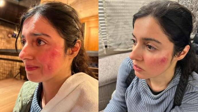 divya khosla kumar injured while shooting for her upcoming project share photos got trolled KPJ