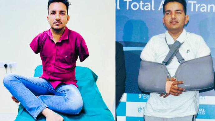 Rajasthan man becomes first Asian to undergo total arm transplant