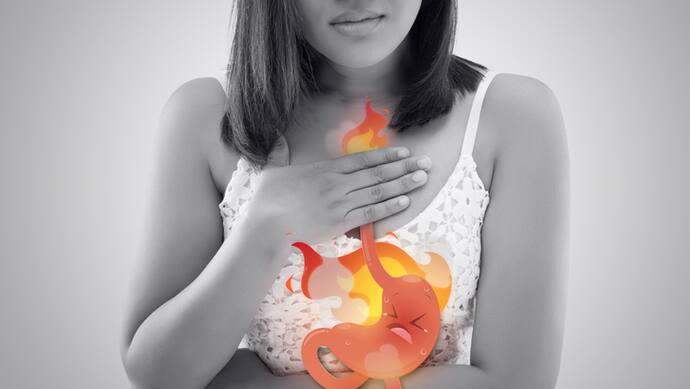 gastric or heartburn problem