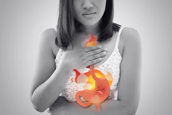 gastric or heartburn problem