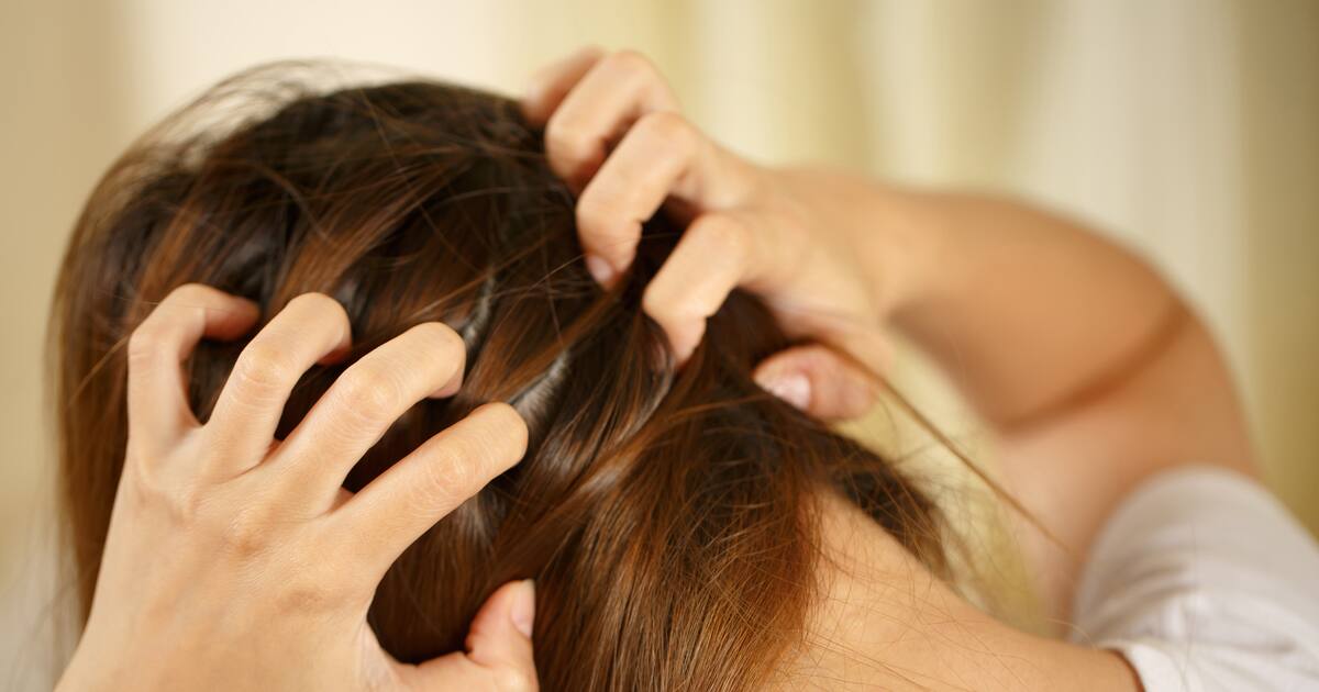 why-do-i-have-itchy-scalp-during-pregnancy-how-to-treat-it