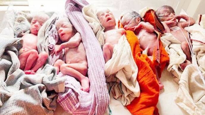 woman gave birth to ive children at once in  rims hospital ranchi